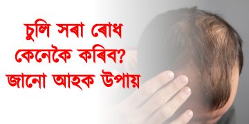 চুলি সৰা ৰোধ কেনেকৈ কৰিব? জানো আহক উপায়