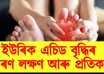 ইউৰিক এচিড বৃদ্ধিৰ কাৰণ, লক্ষণ আৰু প্ৰতিকাৰ