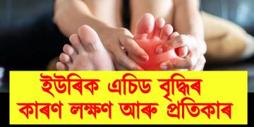 ইউৰিক এচিড বৃদ্ধিৰ কাৰণ, লক্ষণ আৰু প্ৰতিকাৰ