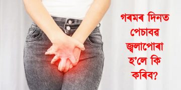 গৰমৰ দিনত পেচাবৱ জ্বলাপোৰা হ’লে কি কৰিব?