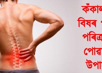 কঁকালৰ বিষৰ পৰা পৰিত্ৰাণ পোৱাৰ উপায়