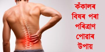 কঁকালৰ বিষৰ পৰা পৰিত্ৰাণ পোৱাৰ উপায়