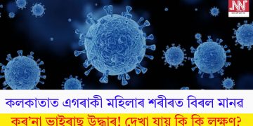 কলকাতাত এগৰাকী মহিলাৰ শৰীৰত বিৰল মানৱ কৰ’না ভাইৰাছ উদ্ধাৰ! দেখা যায় কি কি লক্ষণ?