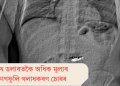 ৫ লাখ ডলাৰতকৈ অধিক মূল্যৰ চুৰি কাণফুলি গলাধকৰণ চোৰৰ  