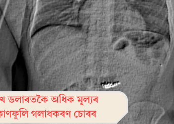 ৫ লাখ ডলাৰতকৈ অধিক মূল্যৰ চুৰি কাণফুলি গলাধকৰণ চোৰৰ  