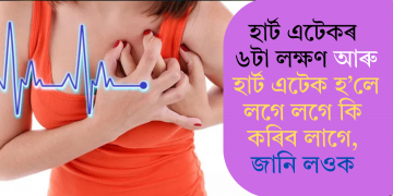হাৰ্ট এটেকৰ ৬টা লক্ষণ আৰু হাৰ্ট এটেক হ’লে লগে লগে কি কৰিব লাগে, জানি লওক