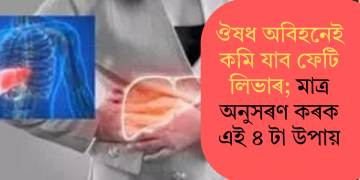 ঔষধ অবিহনেই কমি যাব ফেটি লিভাৰ; মাত্ৰ অনুসৰণ কৰক এই ৪ টা উপায়