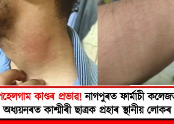 পেহেলগাম কাণ্ডৰ প্ৰভাৱ! নাগপুৰত ফাৰ্মাচী কলেজত অধ্যয়নৰত কাশ্মীৰী ছাত্ৰক প্ৰহাৰ স্থানীয় লোকৰ