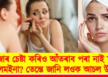 হাজাৰ চেষ্টা কৰিও আঁতৰাব পৰা নাই মুখৰ শালমইনা? তেন্তে জানি লওক আচল উপায়