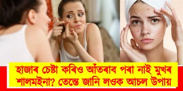 হাজাৰ চেষ্টা কৰিও আঁতৰাব পৰা নাই মুখৰ শালমইনা? তেন্তে জানি লওক আচল উপায়