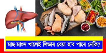 মাছ-মাংস খালেই লিভাৰ বেয়া হ’ব পাৰে নেকি? জানো আহক