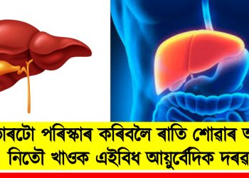 লিভাৰটো পৰিস্কাৰ কৰিবলৈ ৰাতি শোৱাৰ আগত নিতৌ খাওক এইবিধ আয়ুৰ্বেদিক দৰৱ