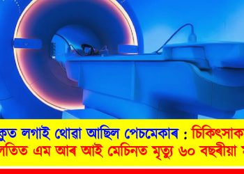 বুকুত লগাই থোৱা আছিল পেচমেকাৰ : চিকিৎসাকৰ্মীৰ গাফিলতিত এম আৰ আই মেচিনত ছটফটাই মৃত্যু ৬০ বছৰীয়া মহিলাৰ