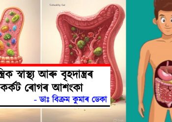 আন্ত্ৰিক স্বাস্থ্য আৰু বৃহদান্ত্ৰৰ কৰ্কট ৰোগৰ আশংকা