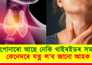 আপোনাৰো আছে নেকি থাইৰইডৰ সমস্যা? কেনেদৰে যত্ন ল’ব জানো আহক