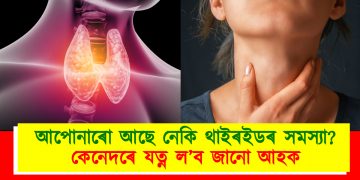 আপোনাৰো আছে নেকি থাইৰইডৰ সমস্যা? কেনেদৰে যত্ন ল’ব জানো আহক