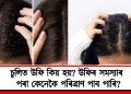 চুলিত উফি কিয় হয়? উফিৰ সমস্যাৰ পৰা কেনেকৈ পৰিত্ৰাণ পাব পাৰি?