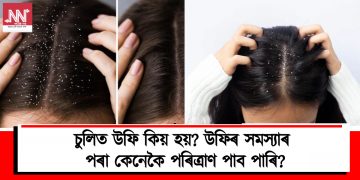 চুলিত উফি কিয় হয়? উফিৰ সমস্যাৰ পৰা কেনেকৈ পৰিত্ৰাণ পাব পাৰি?