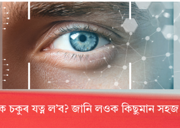কেনেকৈ চকুৰ যত্ন ল’ব ? জানি লওক কিছুমান সহজ উপায়