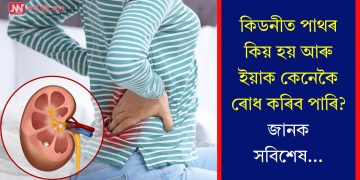 কিডনীত পাথৰ কিয় হয় আৰু ইয়াক কেনেকৈ ৰোধ কৰিব পাৰি? জানক সবিশেষ…