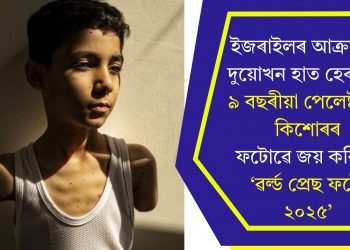 ইজৰাইলৰ আক্ৰমণত দুয়োখন হাত হেৰুওৱা ৯ বছৰীয়া পেলেষ্টাইনী কিশোৰৰ ফটোৱে জয় কৰিলে ‘ৱৰ্ল্ড প্ৰেছ ফটো ২০২৫’