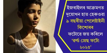 ইজৰাইলৰ আক্ৰমণত দুয়োখন হাত হেৰুওৱা ৯ বছৰীয়া পেলেষ্টাইনী কিশোৰৰ ফটোৱে জয় কৰিলে ‘ৱৰ্ল্ড প্ৰেছ ফটো ২০২৫’