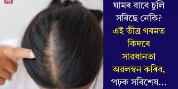 ঘামৰ বাবে চুলি সৰিছে নেকি? এই তীব্ৰ গৰমত কিদৰে সাৱধানতা অৱলম্বন কৰিব, পঢ়ক সবিশেষ…