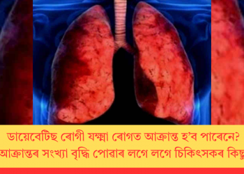 ডায়েবেটিছ ৰোগী যক্ষ্মা ৰোগত আক্ৰান্ত হ’ব পাৰেনে? দেশত আক্ৰান্তৰ সংখ্যা বৃদ্ধি পোৱাৰ লগে লগে চিকিৎসকৰ কিছু পৰামৰ্শ