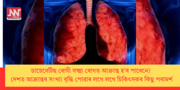 ডায়েবেটিছ ৰোগী যক্ষ্মা ৰোগত আক্ৰান্ত হ’ব পাৰেনে? দেশত আক্ৰান্তৰ সংখ্যা বৃদ্ধি পোৱাৰ লগে লগে চিকিৎসকৰ কিছু পৰামৰ্শ