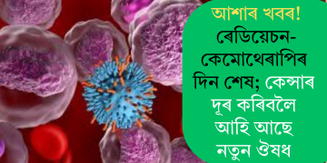 আশাৰ খবৰ! ৰেডিয়েচন-কেমোথেৰাপিৰ দিন শেষ; কেন্সাৰ দূৰ কৰিবলৈ আহি আছে নতুন ঔষধ