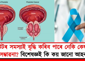 প্ৰষ্টেটৰ সমস্যাই বৃদ্ধি কৰিব পাৰে নেকি কেন্সাৰৰ সম্ভাৱনা? বিশেষজ্ঞই কি কয় জানো আহক –