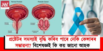 প্ৰষ্টেটৰ সমস্যাই বৃদ্ধি কৰিব পাৰে নেকি কেন্সাৰৰ সম্ভাৱনা? বিশেষজ্ঞই কি কয় জানো আহক –