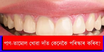 পাণ-তামোল খোৱা দাঁত কেনেকৈ পৰিস্কাৰ কৰিব?