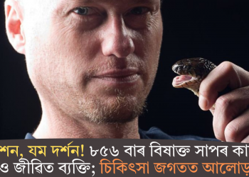 সৰ্প দংশন, যম দৰ্শন! ৮৫৬ বাৰ বিষাক্ত সাপৰ কামোৰ খাইও জীৱিত ব্যক্তি; চিকিৎসা জগতত আলোড়ন