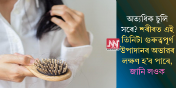 অত্যধিক চুলি সৰে? শৰীৰত এই তিনিটা গুৰুত্বপূৰ্ণ উপাদানৰ অভাৱৰ লক্ষণ হ’ব পাৰে, জানি লওক