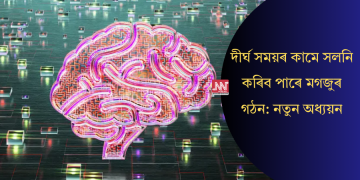 দীৰ্ঘ সময়ৰ কামে সলনি কৰিব পাৰে মগজুৰ গঠন: নতুন অধ্যয়ন