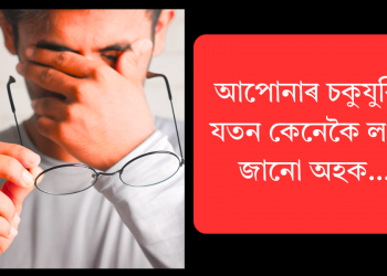 আপোনাৰ চকুযুৰিৰ যতন কেনেকৈ ল’ব? জানো আহক…