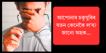 আপোনাৰ চকুযুৰিৰ যতন কেনেকৈ ল’ব? জানো আহক…