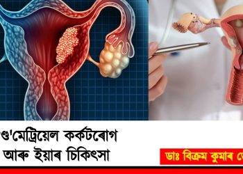 এণ্ড’মেট্ৰিয়েল কৰ্কটৰোগ আৰু ইয়াৰ চিকিৎসা