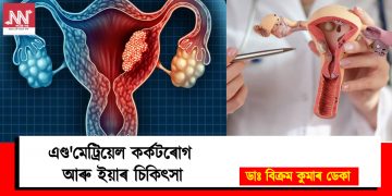 এণ্ড’মেট্ৰিয়েল কৰ্কটৰোগ আৰু ইয়াৰ চিকিৎসা