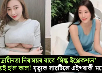 নিদ্ৰাহীনতা নিৰাময়ৰ বাবে ‘মিল্ক ইঞ্জেকশ্যন’ থেৰাপীয়েই হ’ল কাল! মৃত্যুক সাৱটিলে এইগৰাকী মডেলে