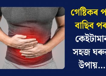 গেষ্টিকৰ পৰা বাছিব পৰা কেইটামান সহজ ঘৰুৱা উপায়…