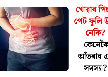 খোৱাৰ পিছত পেট ফুলি উঠে নেকি? কেনেকৈ আঁতৰাব এই সমস্যা?