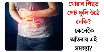 খোৱাৰ পিছত পেট ফুলি উঠে নেকি? কেনেকৈ আঁতৰাব এই সমস্যা?