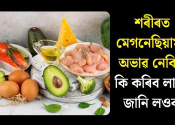 শৰীৰত মেগনেছিয়ামৰ অভাৱ নেকি? কি কৰিব লাগে জানি লওক