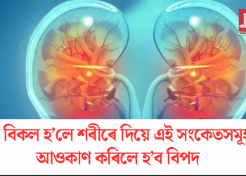 বৃক্ক বিকল হ’লে শৰীৰে দিয়ে এই সংকেতসমূহ! আওকাণ কৰিলে হ’ব বিপদ
