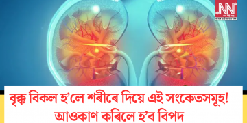 বৃক্ক বিকল হ’লে শৰীৰে দিয়ে এই সংকেতসমূহ! আওকাণ কৰিলে হ’ব বিপদ