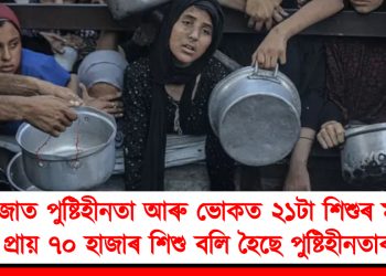 গাজাত পুষ্টিহীনতা আৰু ভোকত ২১টা শিশুৰ মৃত্যু