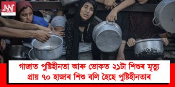 গাজাত পুষ্টিহীনতা আৰু ভোকত ২১টা শিশুৰ মৃত্যু