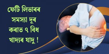 ফেটি লিভাৰৰ সমস্যা দূৰ কৰাত ৭ বিধ খাদ্যৰ যাদু !